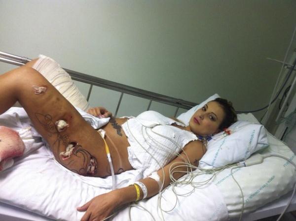 Andressa Urach durante processo de retirada do hidrogel da perna.(Imagem: Grosby Group/ Agência)