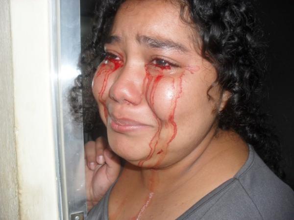 Débora Oliveira dos Santos, de 17 anos, afirma sangrar pelos olhos quando fica nervosa. A foto acima foi tirada por uma prima da estudante durante uma de suas crises (Imagem:Diana Viana de Oliveira / Reprodução)