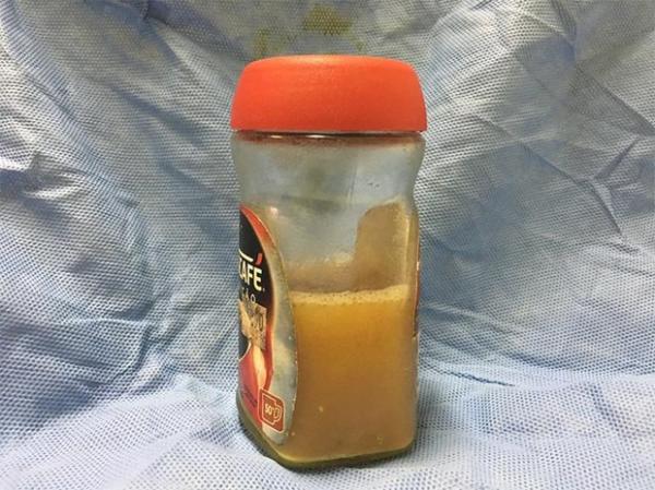 Liquido que a criança pode ter ingerido depois de ter participado de ritual no Piauí.(Imagem:G1 PI)