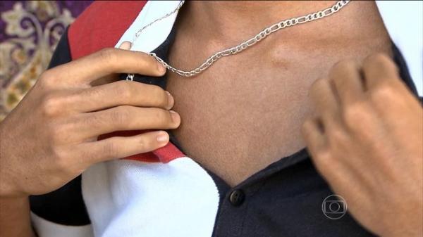 Zika vírus tem como sintoma erupções na pele e coceiras: especialistas estudam relação do zika com a síndrome de Guillain-Barré.(Imagem:Reprodução / TV Globo)