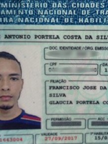 Kleydson Antônio, 23 anos, foi atingido por fios de alta tensão caídos na rua.(Imagem:Gil Oliveira/G1)
