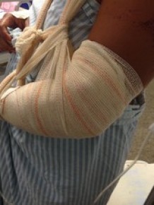 Mulher teve cortes no braço esquerdo quando tentou se defender.(Imagem:Gilcilene Araújo/G1)