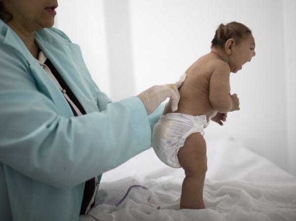 Bebê com menos de 3 meses que nasceu com microcefalia é examinado por neurologista.(Imagem:Felipe Dana/AP)
