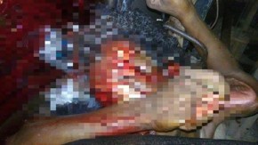 Homem tem corpo dilacerado ao ser atropelado por carreta no interior do PI.(Imagem:Portaldeolho.com)
