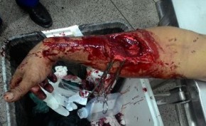 Homem é lesionado a faca durante briga em Floriano.(Imagem:PiauíNotícias)