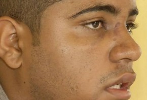 Jovem espancado diz ter sido alvo de racismo por usar tênis caro.(Imagem:Reprodução/TV Cidade Verde)