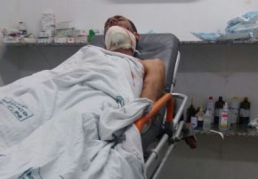 Homem é ferido a golpes de faca em Floriano.(Imagem:PiauíNoticias)