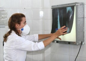 Tuberculose mata 4.500 pessoas todos os dias no mundo.(Imagem:Divulgação)