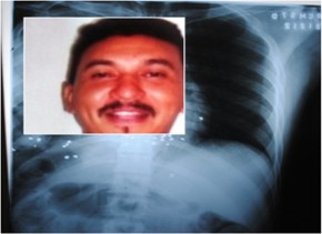 Daniel Oliveira de Araújo, de 33 anos, foi assassinado com tiro(Imagem:meionorte)
