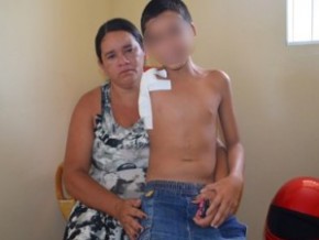 Garoto sofreu uma fratura no braço após cair de um cavalo.(Imagem:Tacyane Machado)