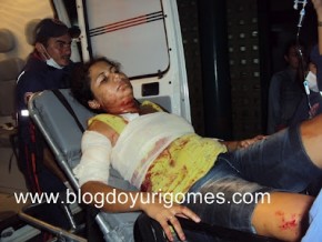Mulher é agredida violentamente com 10 furadas de canivete pelo ex- namorado.(Imagem:Blog do Yuri Gomes)