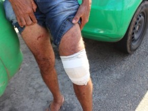 Idoto teve um dos joelhos fraturados.(Imagem:Ellyo Teixeira/ G1)