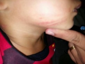 Também foi possível observar marcas no rosto da criança.(Imagem:Divulgação/Polícia Militar)