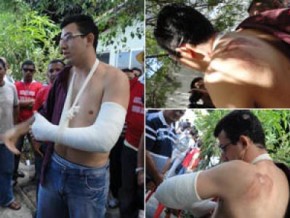 Alexandre Rios foi atropelado durante protesto da PM.(Imagem:Reprodução)