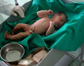 Recém-nascida é resgatada com vida dentro de sacola plástica.(Imagem:Cidadeverde.com)
