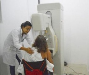 Ceir oferece mamografia para mulheres com deficiência.(Imagem:Cidadeverde.com)