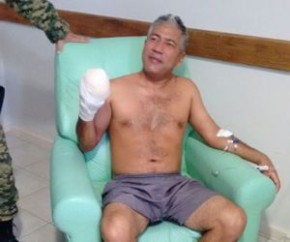 PM ferido após explosão de bomba poderá ter dedos reimplantados.(Imagem:Cidadeverde.com)