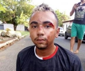 Suspeito de assalto sofre tentativa de linchamento em Teresina.(Imagem:Divulgação)