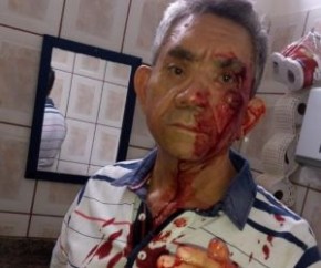 Professor é agredido a socos por aluno de 14 anos e relata medo.(Imagem:Divulgação)