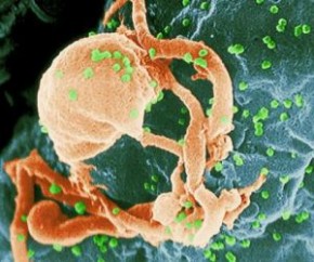 Expectativa de vida de infectados com HIV já está perto do normal.(Imagem:Divulgação)