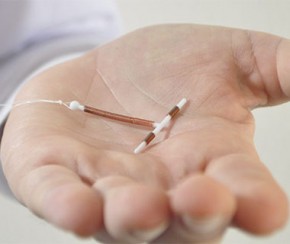 Ministério amplia acesso ao contraceptivo DIU no Sistema Único de Saúde.(Imagem:Divulgação)