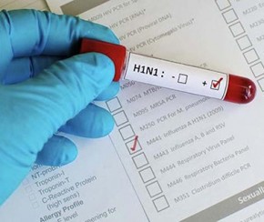 Fundação Municipal de Saúde confirma 1ª morte por H1N1.(Imagem:Cidadeverde.com)