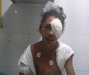 Travesti perde olho esquerdo após tentativa de homicídio.(Imagem:Arquivo pessoal)