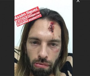 Cliente denuncia agressão em casa noturna de Teresina.(Imagem:Instagram)