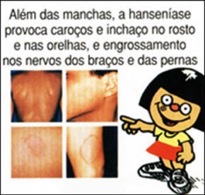 Divulgação dos sintomas(Imagem:Floriano News)
