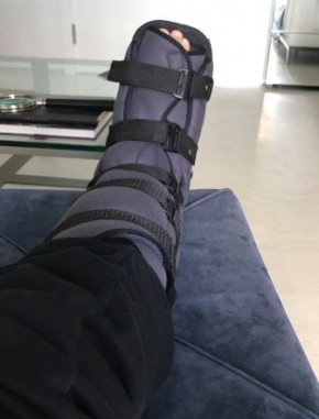 O jornalista publicou uma foto do pé imobilizado.(Imagem:Reprodução/Twitter)