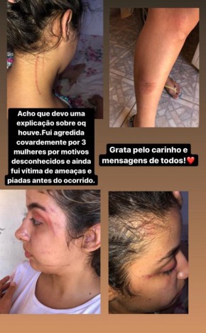 Blogueira é agredida por três mulheres ao sair de festa; Polícia investiga(Imagem:Reprodução/Instagram)