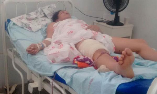 Técnica em enfermagem é atingida por bala perdida e diz que tiro partiu de arma da PM.(Imagem:cidadeverde.com)