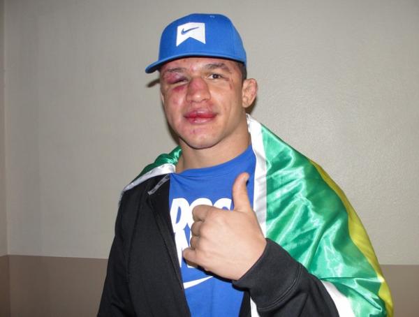 Cigano na saída do hospital, em Las Vegas, após a derrota no UFC 155.(Imagem:Marcelo Russio / SporTV.com)