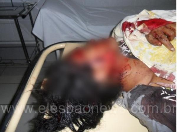 Triplo homicídio no Povoado Chapadinha, zona rural de Elesbão Veloso(Imagem:ElesbaoNews)