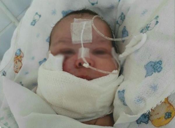 Inquérito confirma que pai arrancou o lábio do bebê que segue internado no HUT.(Imagem:CidadeVerde.com)