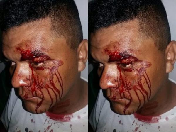 Radialista sofre tentativa de homicídio em Cabeceiras.(Imagem:Longah.com)