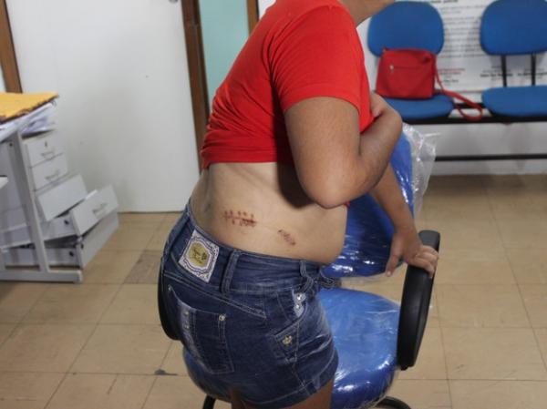 Mulher diz ter sido atacada e atingida por cinco facadas.(Imagem:Ellyo Teixeira/G1)