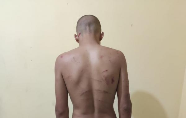 Adolescente foi torturado e agredido pelo namorado no Piauí.(Imagem:Divulgação/Polícia Civil)