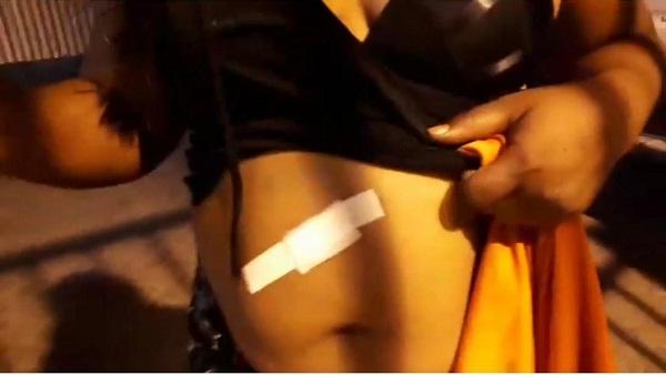 Mulher é ferida a golpes de faca em Floriano.(Imagem:Jc24horas)