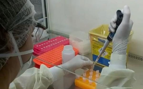 Número de casos confirmados de coronavírus sobe para 40 no Piauí; sete óbitos são registrados(Imagem:Reprodução/TV Anhanguera)