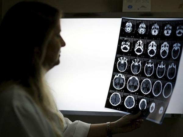 Médica observa tomografia de bebê com microcefalia em hospital.(Imagem:Ueslei Marcelino/Reuters)