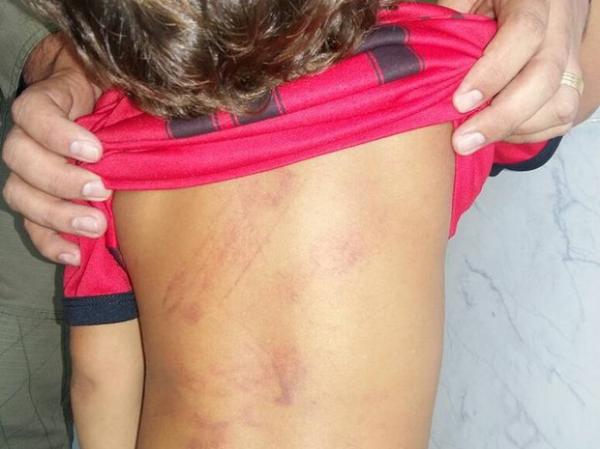 Criança ficou com as costas lesionadas.(Imagem:Divulgação/Polícia Militar)
