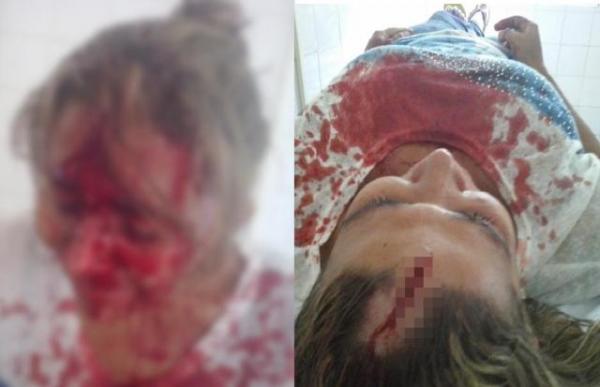 Jovem é agredida a paulada pelo próprio irmão no Piauí(Imagem:Meionorte.com)