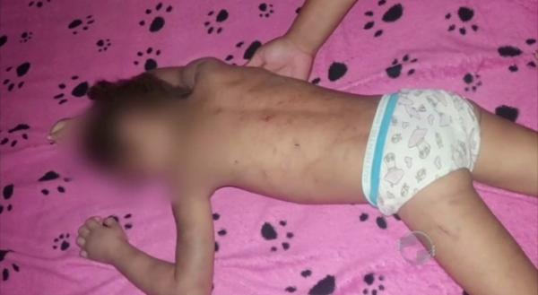 Laudo diz que criança surda foi estuprada e sofre da Síndrome do Espancamento.(Imagem:Cidadeverde.com)