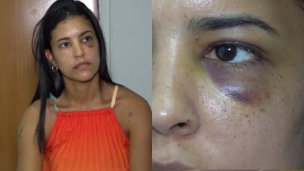 Suspeito de agredir secretária tem alta, presta depoimento e segue em liberdade(Imagem:Reprodução)