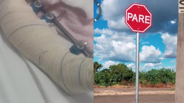 Menina de quatro anos é atropelada por carro em Teresina.(Imagem:Reprodução)