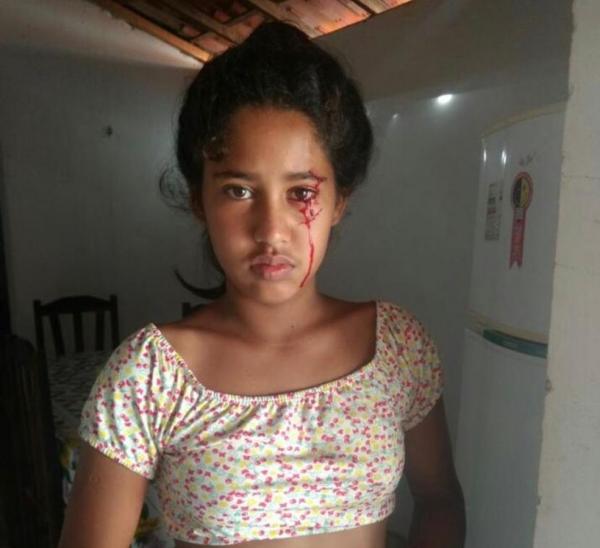 Menina de 12 anos sangra pelos olhos e assusta família no Norte do Piauí.(Imagem:Arquivo pessoal/ Luciana Barbosa)