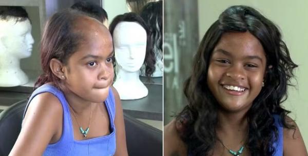 A adolescente recebeu a doação da prótese de um cabeleireiro, que se sensibilizou com a história da garotinha.(Imagem:TV Clube)
