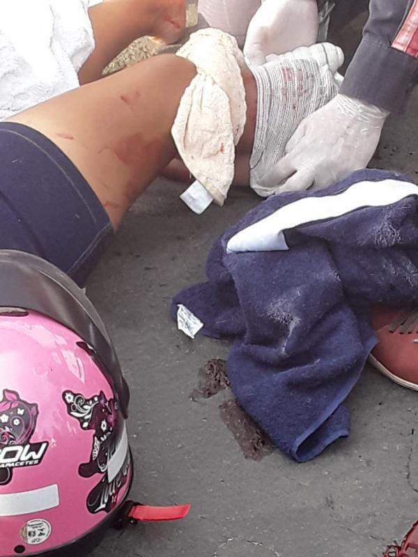 Acidente no Centro de Floriano, deixa mulher com fraturas expostas (Imagem:Reprodução)
