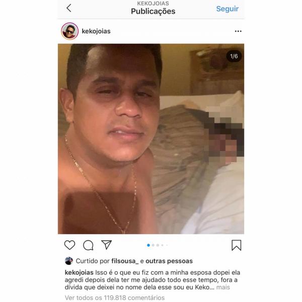 Mulher é dopada e espancada por marido; suspeito publicou agressão(Imagem:Reprodução)